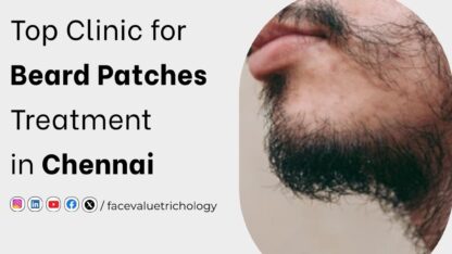 Best-Beard-Transplant-Clinic-in-Chennai