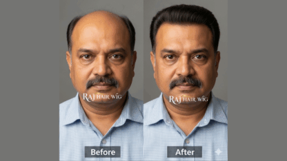 Best-Hair-Wig-Shop-in-Delhi-–-Natural-Look-Guaranteed