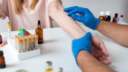 Fungal-Infection-Treatment