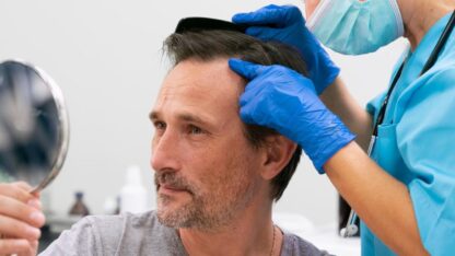 Hair-Transplant-1229×1536-1