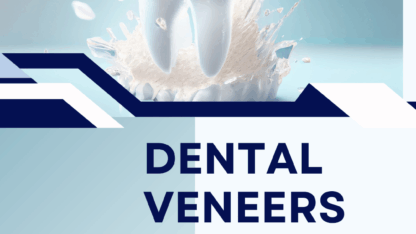 dental-veneers-6