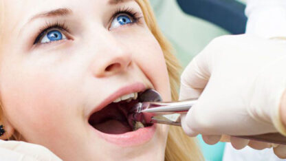 page-banner-tooth-extraction-1200×500-1