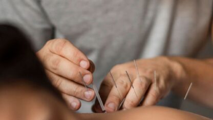 Dry-Needling-Therapy-in-Langle-BC-Nearme