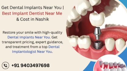 Get-Dental-Implants-Near-You-Best-Implant-Dentist-Cost-in-Nashik