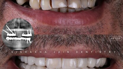 WhatsApp-Image-2025-11-03-at-5.07.13-PM