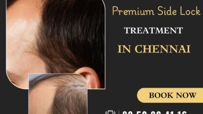 Best-Hair-Transplant-Clinic-in-Chennai