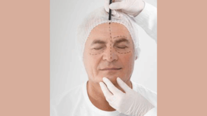 Rinoplastica-Naso-Prezzo