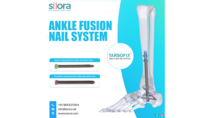 Advanced-Stability-for-Ankle-Fusion-Procedures