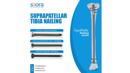 Advancing-Tibial-Fracture-Care-with-Suprapatellar-Nailing-1
