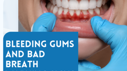 Bleeding-Gums-And-Bad-Breath-Warning-Signs
