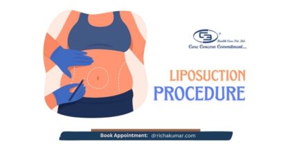 Fat-Removal-Body-Sculpting-Book-Your-Liposuction-Now