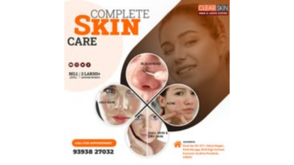 Hair-Transplant-Treatment-in-india