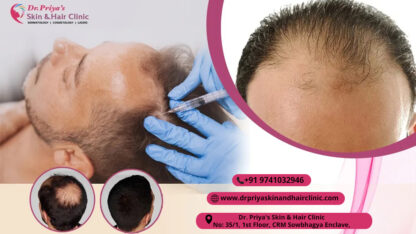 Looking-for-the-Best-Hair-Loss-Treatment-in-Bangalore-Dr.-Priya-Skin-and-Hair-Clinic