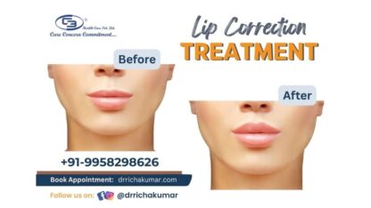 Planning-Rhinoplasty-in-Delhi-7-Costly-Mistakes-Patients-Make-Before-Choosing-a-Surgeon