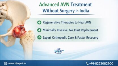 AVN-treatment-without-surgery-in-India-Avascular-Necrosis-without-surgery-in-India