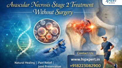 Avascular-Necrosis-Stage-2-Treatment-Without-Surgery
