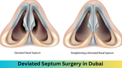 Deviated-Septum-Surgery-in-Dubai