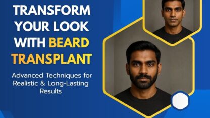 Beard-Transplant-in-Chennai-Natural-Beard-Hair-Transplant-Clinic
