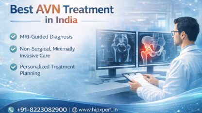 Best-AVN-Treatment-in-India