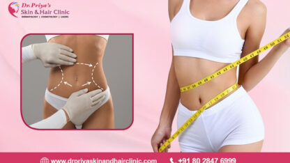 Best-Body-Shaping-In-Bangalore