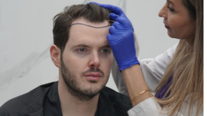 Best-Clinic-for-Hair-Transplant-in-Varanasi-–-Book-Free-Analysis