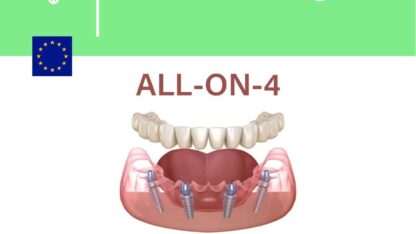 Give-your-smile-a-total-makeover-in-Italy-Our-ALL-ON-4-package-delivers-a-fixed-full-arch-prost