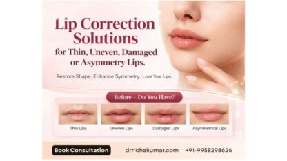 Lip-Correction-Solutions-for-Thin-Uneven-Damaged-or-Asymmetry-Lips