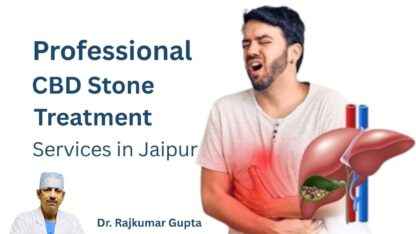 Professional-CBD-Stone-Treatment-Services-in-Jaipur