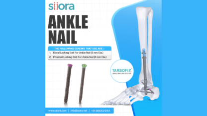 Reliable-Ankle-Nail-for-Stable-and-Confident-Fracture-Fixation