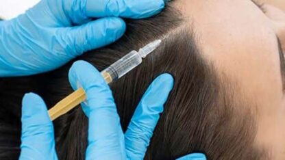 prp-hair-treatment-indirapuram