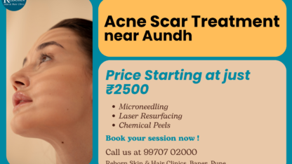 Acne-Scar-Treatment-near-Aundh