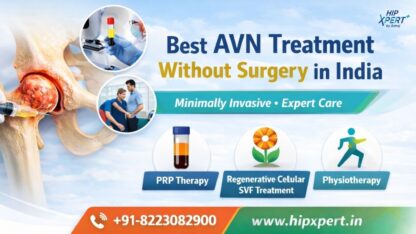 Best-AVN-Treatment-without-Surgery-in-India