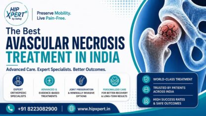 Best-Avascular-Necrosis-AVN-Treatment-in-India
