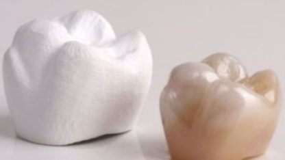 Buy-Full-Zirconia-Dental-Crown-Tooth-at-the-Best-Prices-in-Bulk