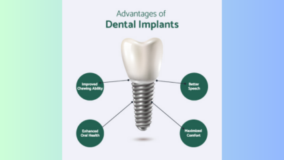 Dental-Implant-Cost