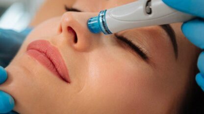 Hydrafacial-Treatment-in-hyderabad
