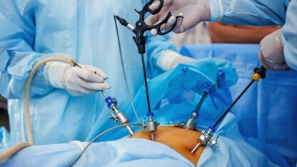Laparoscopic-Surgeon-in-Delhi