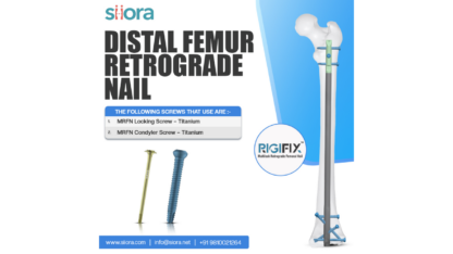 Reliable-Fixation-with-Sioras-Distal-Femur-Retrograde-Nail