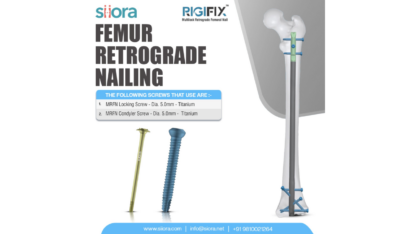 Reliable-Retrograde-Femur-Nailing-Solutions-for-Effective-Fracture-Care