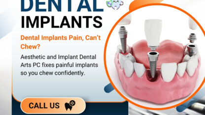 affordable-dental-implants