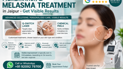 pigmentation-melasma-treatment-jaipur-bapu-nagar