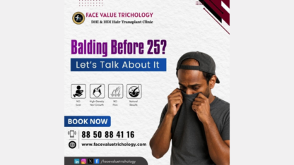 Balding-Before-25-Advanced-Hair-Loss-Treatment-Hair-Transplant-Clinic