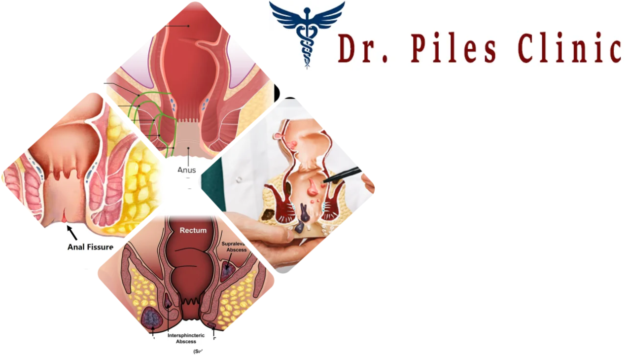 Dr Piles Clinic