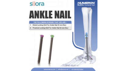 Strong-Support-for-Ankle-Fractures-with-Precision-Ankle-Nails