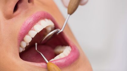 dentist-examining-female-patient-teeth-1