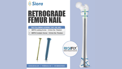 Reliable-Retrograde-Femur-Nails-for-Effective-Distal-Femur-Fracture-Fixation