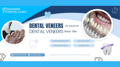 Dental-Veneers-in-Nashik